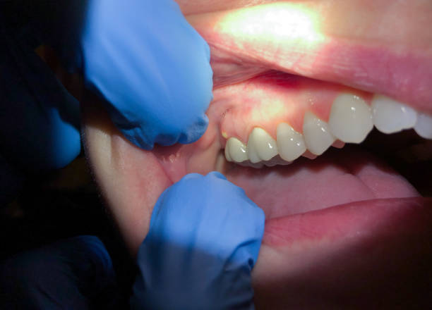 Best Same-Day Emergency Dentist in Crab Orchard, WV