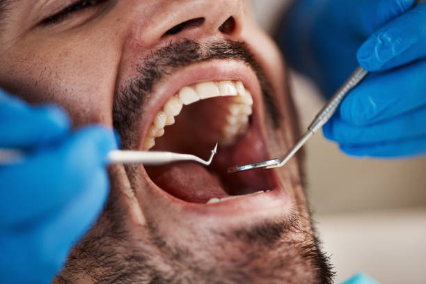 Best Emergency Broken Tooth Repair in Crab Orchard, WV
