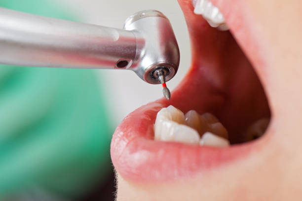 Best After-Hours Emergency Dentist in Crab Orchard, WV